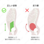 左側の「正しい姿勢」は、肋骨と骨盤が垂直に保たれており、腹筋群（緑色で表示）によって腹圧が維持されている状態が示されている。腹筋と背筋のバランスが良い。 右側の「反り腰」は、骨盤が前傾し、腰が過度に反っている状態が示されており、腹筋群が弱く姿勢が崩れていることが赤いイラストで強調されている。